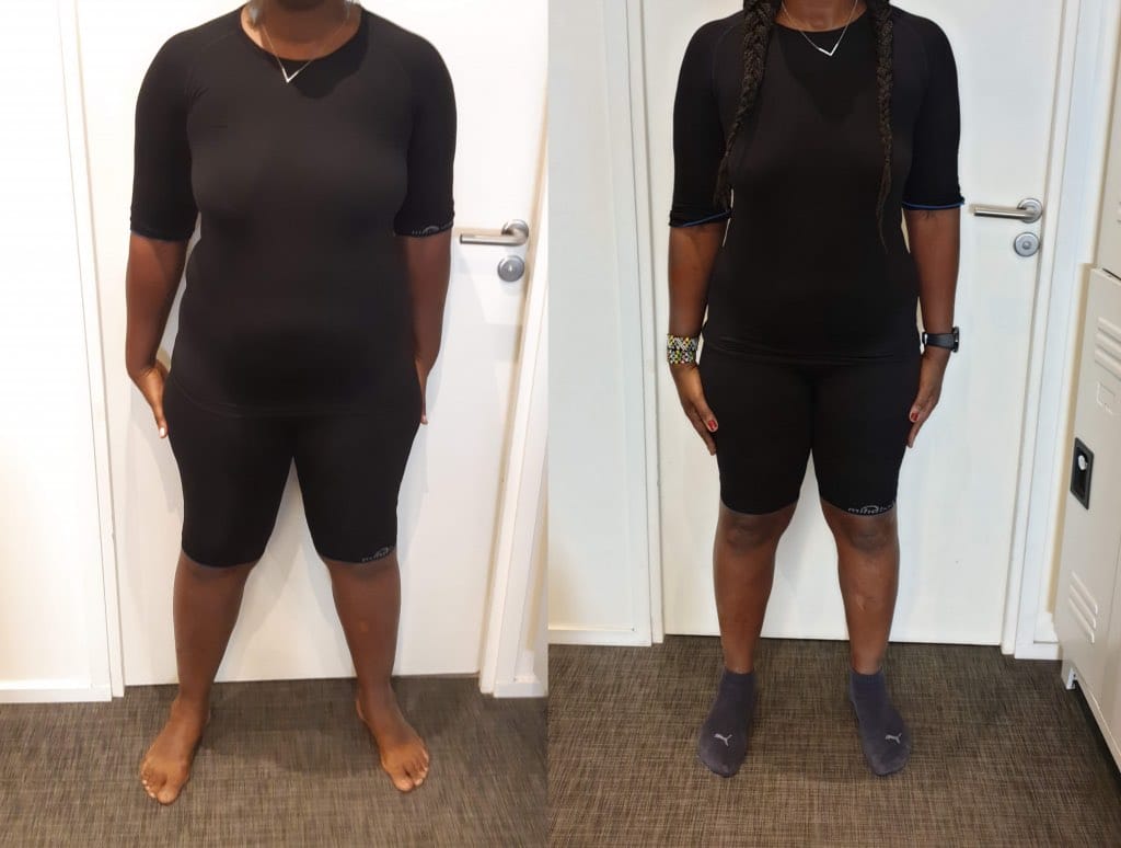 Resulats ems face avant après